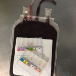 Encuesta sobre diferimiento del donante de sangre por anemia